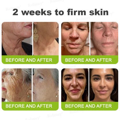 ☘️💎Made and shipped from Australia 💫Rolimey® Botox & Vita-A Retinol Shot Wrinkle-Lift Tightening cream - Last Day Promotion 70% OFF