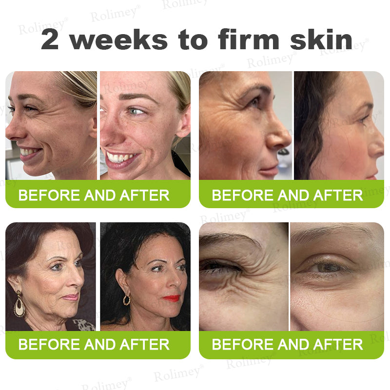 ✔Made and shipped from the USA 💫Rolimey® Botox & Vita-A Retinol Shot Wrinkle-Lift Tightening cream - Last Day Promotion 70% OFF