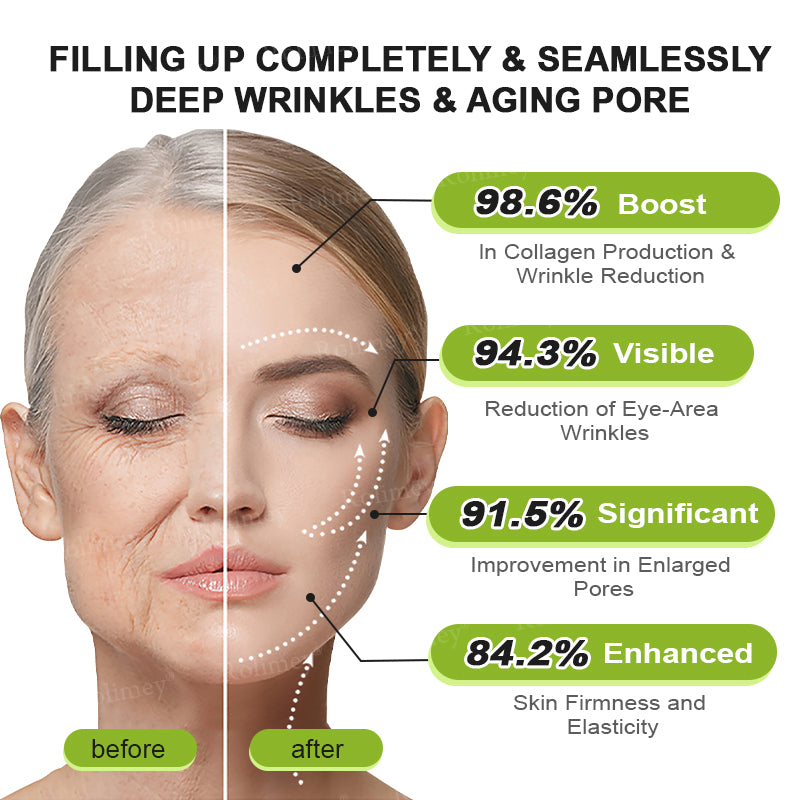 ☘️💎Made and shipped from Australia 💫Rolimey® Botox & Vita-A Retinol Shot Wrinkle-Lift Tightening cream - Last Day Promotion 70% OFF