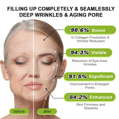 ☘️💎Made and shipped from Australia 💫Rolimey® Botox & Vita-A Retinol Shot Wrinkle-Lift Tightening cream - Last Day Promotion 70% OFF