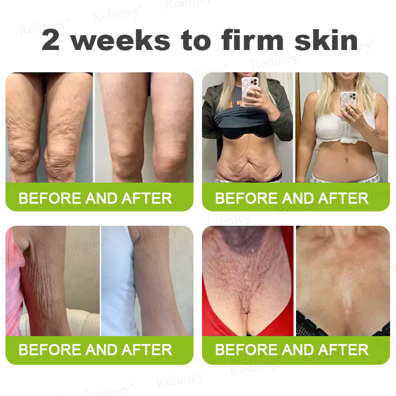 ☘️💎Made and shipped from Australia 💫Rolimey® Botox & Vita-A Retinol Shot Wrinkle-Lift Tightening cream - Last Day Promotion 70% OFF