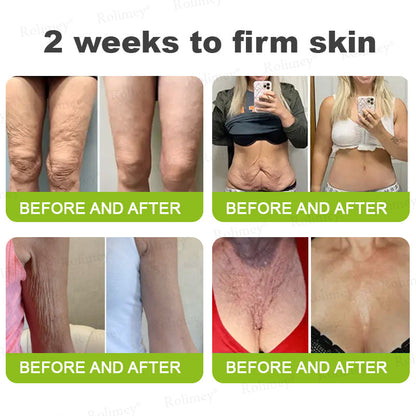 ☘️💎Made and shipped from Australia 💫Rolimey® Botox & Vita-A Retinol Shot Wrinkle-Lift Tightening cream - Last Day Promotion 70% OFF