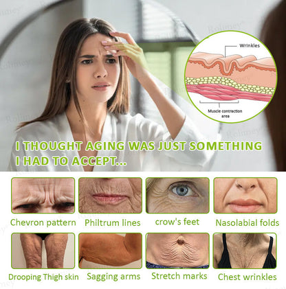 ☘️💎Made and shipped from Australia 💫Rolimey® Botox & Vita-A Retinol Shot Wrinkle-Lift Tightening cream - Last Day Promotion 70% OFF